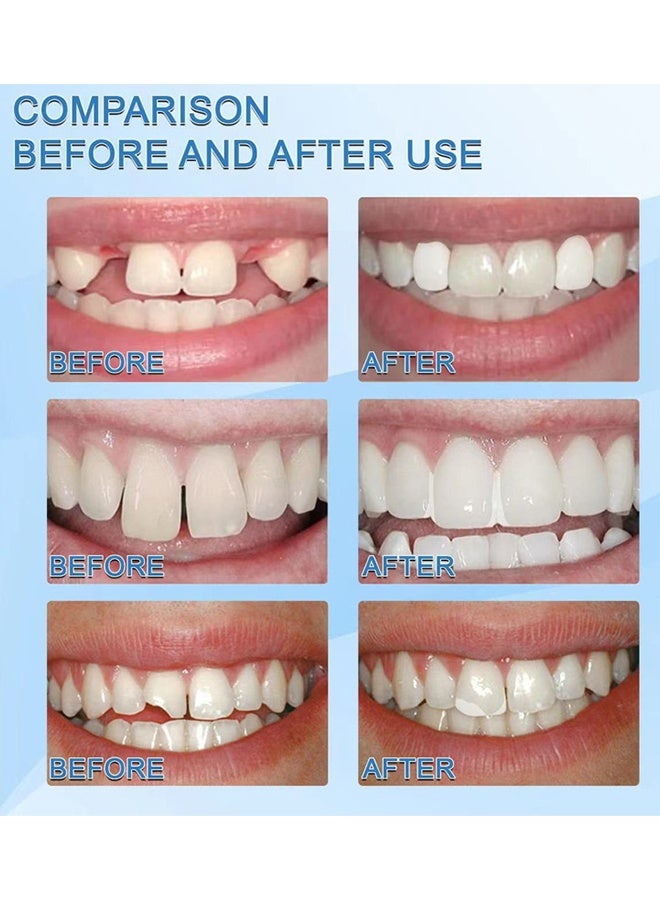 Rozino Temporary Tooth Solid Gel, Moldable Tooth Filling Repair Kit, Dental Care Kit Fixing The Missing and Broken Replacements, DIY Natural Filling Fake Teeth,Smile Confidently Again - Image 5